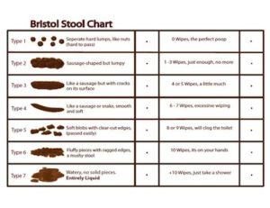 TURD? Qual é o significado e a pronúncia de TURD?